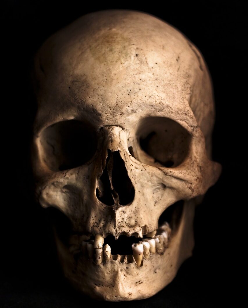 skull, human, head-765477.jpg